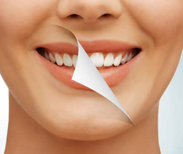 Whitening Your Teeth at Home